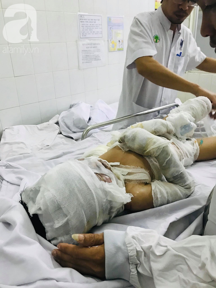 Tình tiết bất ngờ vụ dì tẩm xăng đốt cháu ruột vì món nợ 3 triệu đồng: Bà ngoại biến mất” cùng 200 triệu đồng tiền ủng hộ?-7