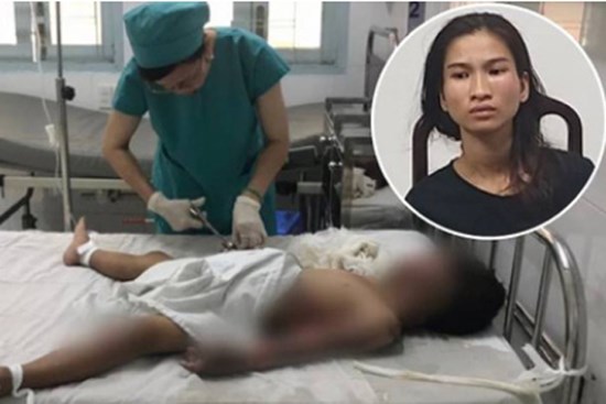 Bé trai 6 tuổi bị dì ruột tẩm xăng đốt ở Vũng Tàu phải điều trị lâu dài cả về thể xác lẫn tâm lý