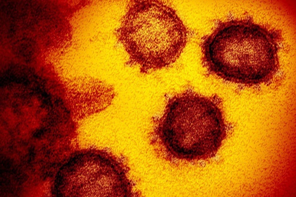 SCMP: Phát hiện SARS-COV-2 có đột biến gen giống HIV và Ebola, hứa hẹn tìm ra cách chữa trị hiệu quả-1