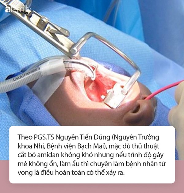 Bé gái 7 tuổi tử vong chỉ sau vài phút phẫu thuật cắt amidan, chuyên gia đưa ra một loạt cảnh báo-3