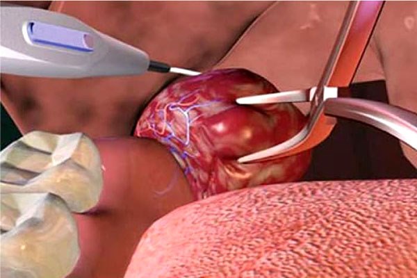 Bé gái 7 tuổi tử vong chỉ sau vài phút phẫu thuật cắt amidan, chuyên gia đưa ra một loạt cảnh báo-4