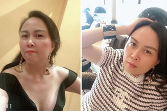 Phượng Chanel giải thích vì sao không 'dao kéo', còn mọi người nghĩ sao về gương mặt cô ấy?