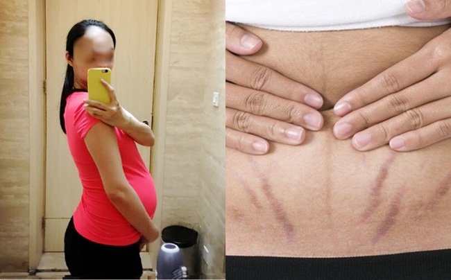 Chỉ vì câu nói Cái bụng gớm quá, vợ quyết ly hôn dù vừa sinh được 6 tháng, câu chuyện tưởng chừng như vô lý này lại là nỗi lòng của nhiều chị em-1