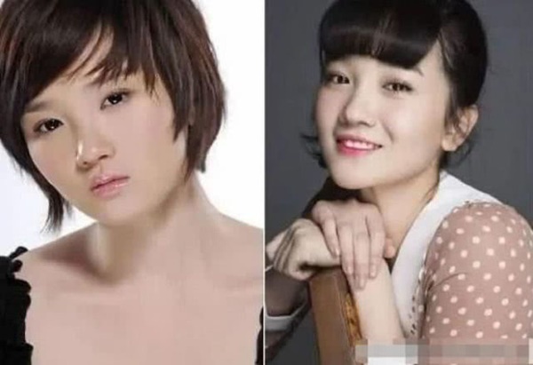 Mỹ nhân showbiz liều mạng làm đẹp: Từ Hy Viên uống thuốc chống đông máu, Song Ji Hyo thay máu để trở nên tươi trẻ-9