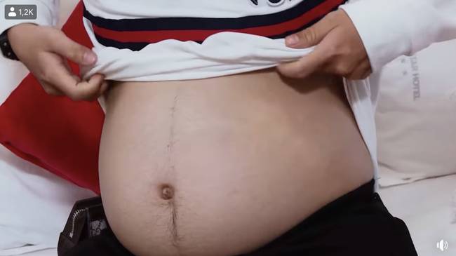 Người đàn ông Việt Nam đầu tiên mang thai thay vợ và lời chia sẻ thật lòng: Bác sĩ bảo chưa từng khám thai cho ai mà lại có lông bụng như thế này hết”-2