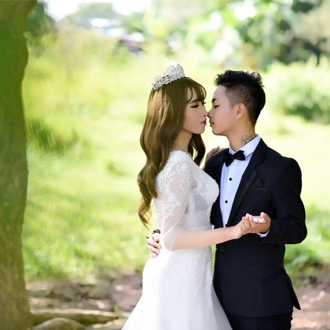 Người đàn ông Việt Nam đầu tiên mang thai thay vợ và lời chia sẻ thật lòng: Bác sĩ bảo chưa từng khám thai cho ai mà lại có lông bụng như thế này hết”-4