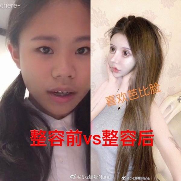 Nghiện phẫu thuật thẩm mỹ từ năm 13 tuổi, thiếu nữ khiến cộng đồng mạng tá hỏa khi công khai những bức ảnh xinh đẹp nhất của mình-1