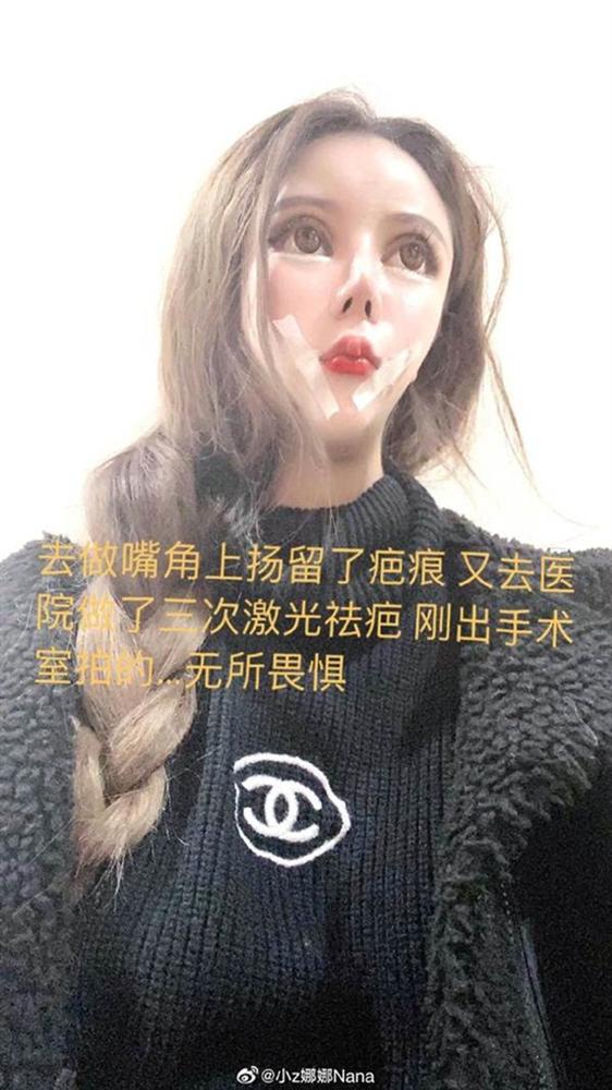 Nghiện phẫu thuật thẩm mỹ từ năm 13 tuổi, thiếu nữ khiến cộng đồng mạng tá hỏa khi công khai những bức ảnh xinh đẹp nhất của mình-2