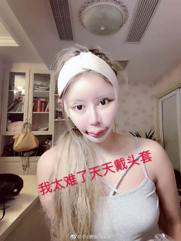 Nghiện phẫu thuật thẩm mỹ từ năm 13 tuổi, thiếu nữ khiến cộng đồng mạng tá hỏa khi công khai những bức ảnh xinh đẹp nhất của mình-3