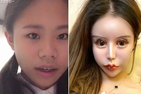 Nghiện phẫu thuật thẩm mỹ từ năm 13 tuổi, thiếu nữ khiến cộng đồng mạng 