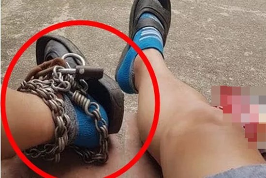 Nam thanh niên tự cột xích vào chân và lý do đằng sau khiến nhiều người cay mắt