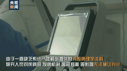 Phổi không còn là phổi! - Báo cáo khám nghiệm tử thi bệnh nhân nhiễm coronavirus hé lộ điều bất thường-4