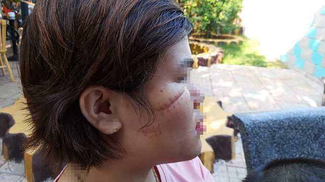 Bắt nhóm côn đồ rạch mặt dã man người phụ nữ ngay trước cổng công ty-2