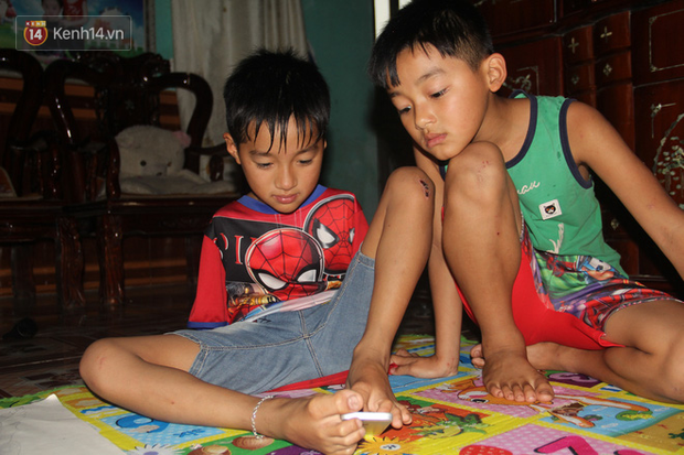 Cậu bé không tay vẽ cuộc đời bằng đôi chân kỳ diệu và câu hỏi thắt lòng: Bao giờ tay con sẽ mọc hả mẹ?”-1