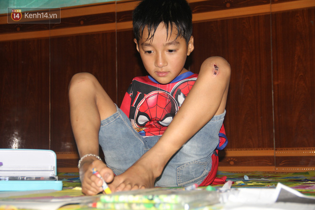 Cậu bé không tay vẽ cuộc đời bằng đôi chân kỳ diệu và câu hỏi thắt lòng: Bao giờ tay con sẽ mọc hả mẹ?”-3