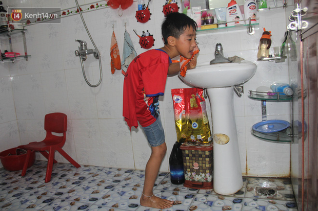 Cậu bé không tay vẽ cuộc đời bằng đôi chân kỳ diệu và câu hỏi thắt lòng: Bao giờ tay con sẽ mọc hả mẹ?”-10