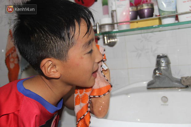 Cậu bé không tay vẽ cuộc đời bằng đôi chân kỳ diệu và câu hỏi thắt lòng: Bao giờ tay con sẽ mọc hả mẹ?”-11