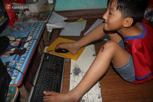 Cậu bé không tay vẽ cuộc đời bằng đôi chân kỳ diệu và câu hỏi thắt lòng: Bao giờ tay con sẽ mọc hả mẹ?”-12