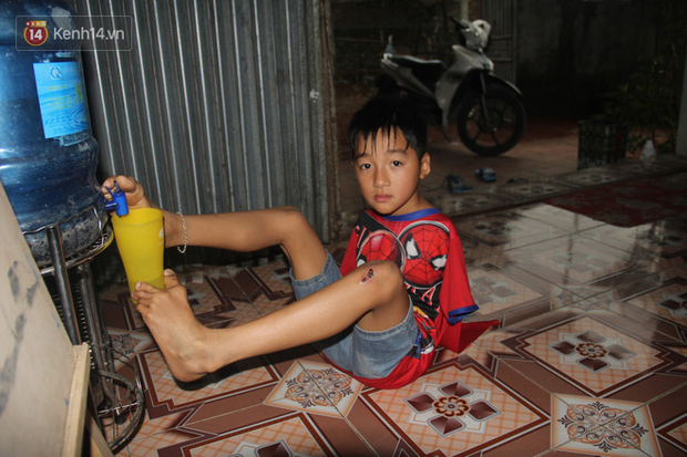 Cậu bé không tay vẽ cuộc đời bằng đôi chân kỳ diệu và câu hỏi thắt lòng: Bao giờ tay con sẽ mọc hả mẹ?”-14