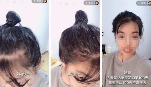Cô gái thực hiện thử thách 100 ngày không gội đầu, hình ảnh chậu nước gội ngày 101 khiến tất cả nín lặng-2