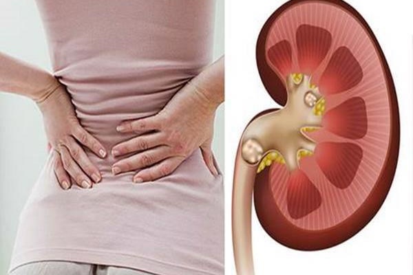 Có những dấu hiệu này, bạn hãy mừng vì thận của mình cực khỏe-5