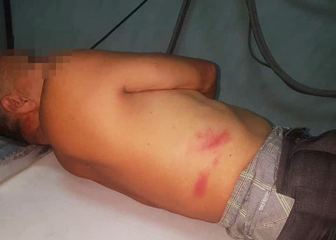 Xôn xao clip cô gái trẻ cầm cây đánh cụ ông gục xuống đường-3