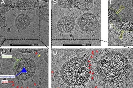 Ảnh hiển vi đầu tiên cho thấy hình dạng thật của virus corona