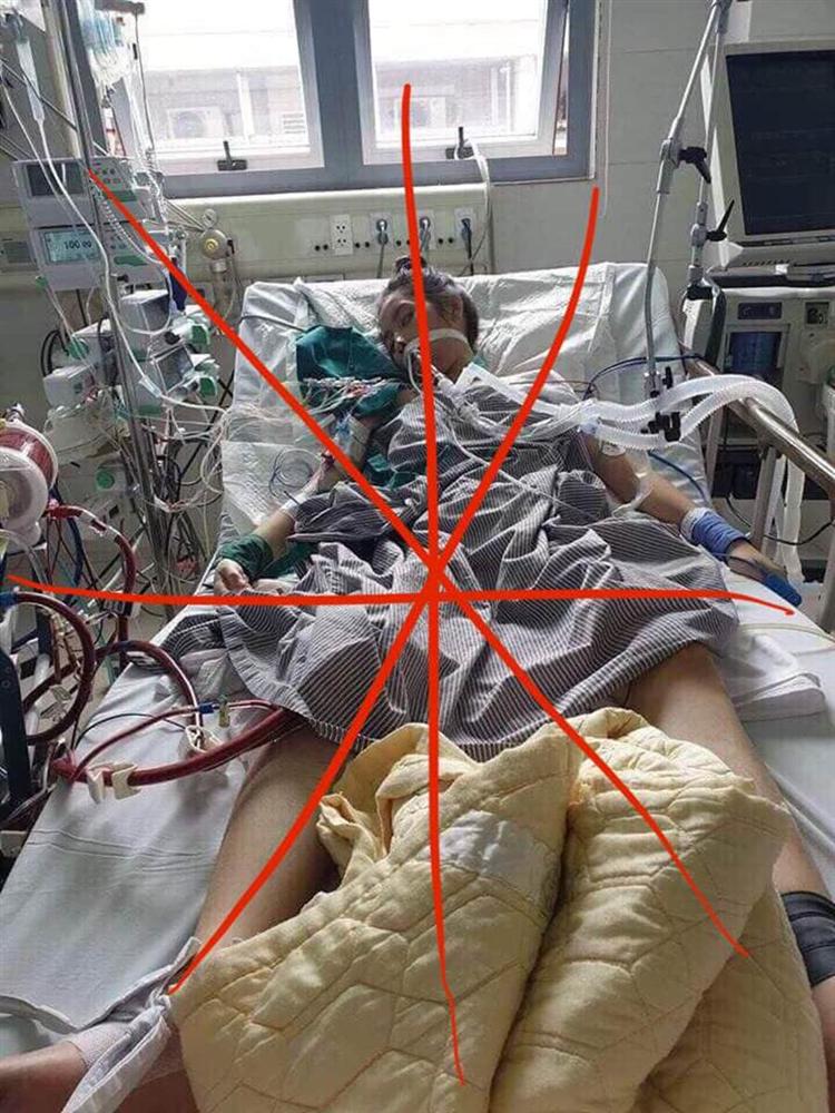 Bộ Y tế lên tiếng về bức ảnh nữ bệnh nhân nguy kịch được cho là cô gái mắc Covid-19-1