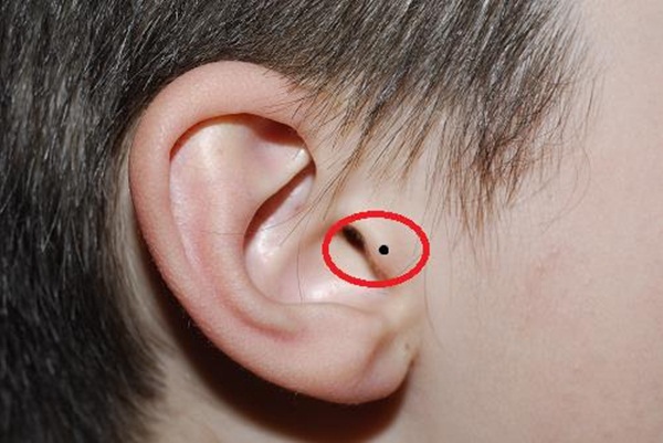 Đàn ông có nốt ruồi ở vị trí này cả đời giàu sang, muốn nghèo cũng khó-4