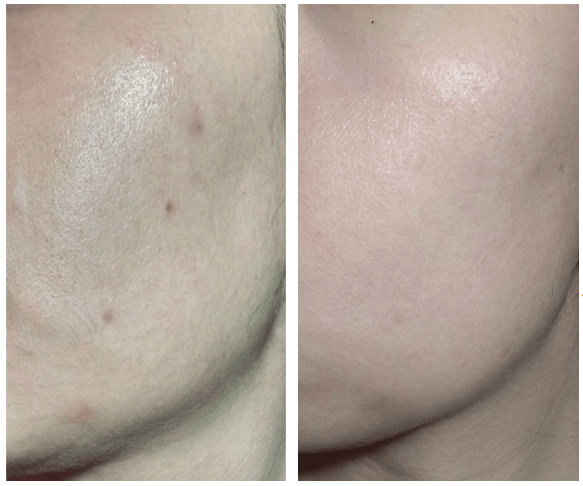 4 loại serum được phái đẹp Nhật tôn vinh là tinh hoa trị thâm nám, trong đó có một loại giá chỉ hơn 200k cực kỳ quen mặt-7