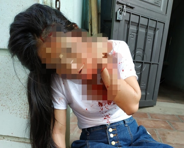 Cụ ông 74 tuổi đâm trọng thương con gái riêng của vợ hờ-1