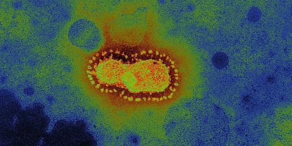 WHO trả lời 21 thông tin quan trọng nhất về Covid-19: Bất cứ ai cũng cần nắm rõ-1