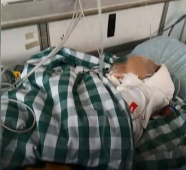 Họa từ trên trời rơi xuống: Được mẹ dẫn đi dạo, đứa bé 14 tháng tuổi bị một viên gạch rơi trúng đỉnh đầu dẫn đến chết não-2