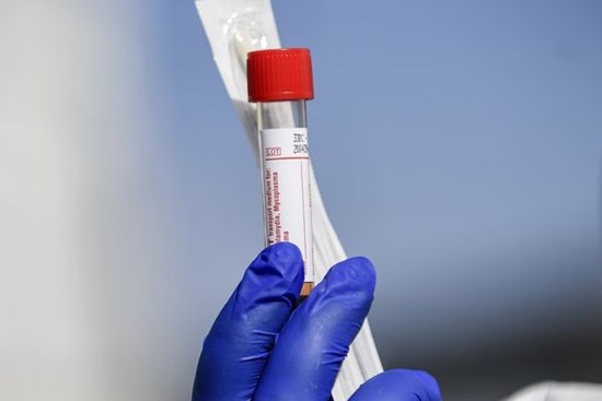 Xét nghiệm virus corona ở Mỹ lộ điểm yếu, có thể sót cả nghìn ca nhiễm