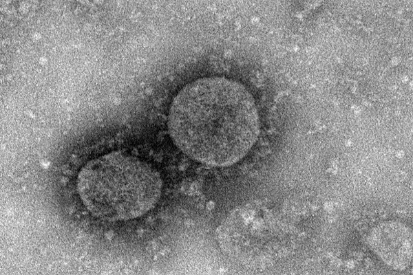 Hệ thống miễn dịch tiêu diệt virus xâm nhập cơ thể như thế nào?-1