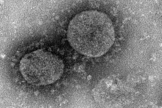 Hệ thống miễn dịch tiêu diệt virus xâm nhập cơ thể như thế nào?