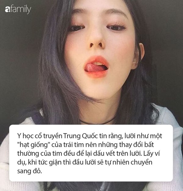 4 dấu hiệu bất thường trên miệng nhận biết có thể bạn đang mắc bệnh tim, cần chủ động đi khám sớm-3