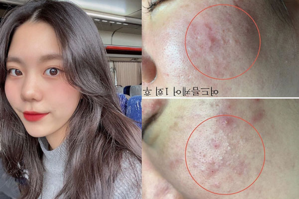 Công thức trang điểm mùa hè siêu nhẹ mặt của Jennie-8