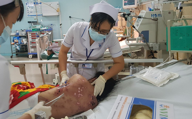 Ông chủ quán cà phê tra tấn cô gái như thời trung cổ vì không chịu kích dục cho khách ở Đồng Nai khai gì?-1