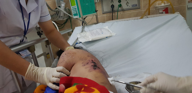 Ông chủ quán cà phê tra tấn cô gái như thời trung cổ vì không chịu kích dục cho khách ở Đồng Nai khai gì?-3