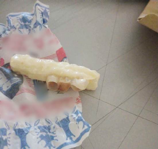 Đang nằm nhà nhai kẹo ôn lại tuổi thơ, cô gái bỗng thấy trong miệng có gió lùa vì rụng một lúc 3 chiếc răng-1