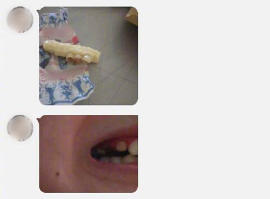 Đang nằm nhà nhai kẹo ôn lại tuổi thơ, cô gái bỗng thấy trong miệng có gió lùa vì rụng một lúc 3 chiếc răng-2