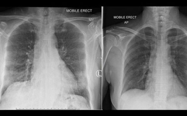 Phát hiện cách hệ miễn dịch chống lại virus Corona-1