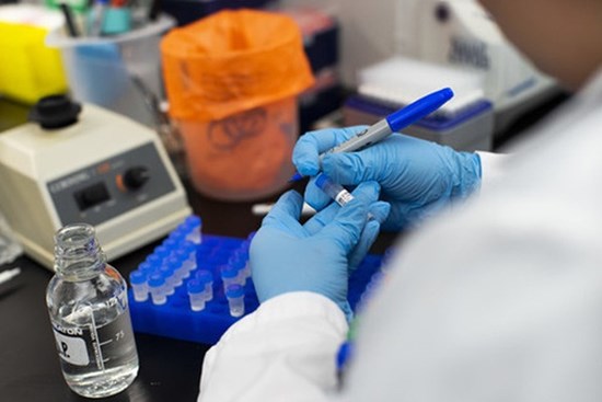 BS Trương Hữu Khanh: Có nên mở dịch vụ xét nghiệm Covid-19 cho người cách ly tại nhà?