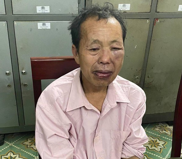 Một công an hy sinh khi vây bắt tội phạm ma túy-1