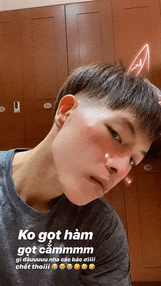 Phẫu thuật thành công nhưng nụ cười hở lợi bao năm của Đức Phúc vẫn không cách nào sửa nổi-7