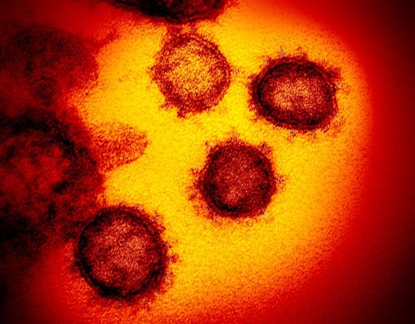 Tại sao virus corona không sống nhưng rất khó tiêu diệt?-2
