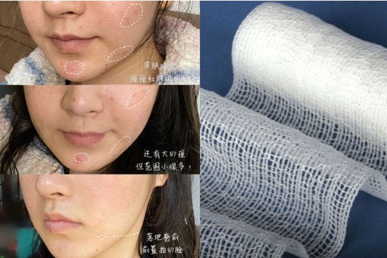 Tuyệt đỉnh bí kíp làm sạch từ chuyên gia nổi tiếng: Dùng miếng gạc để lau mặt, da mịn mướt thật chứ không hư cấu