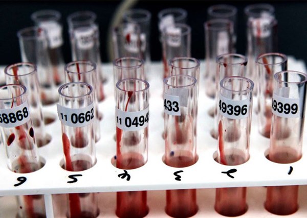 Điều gì sẽ xảy ra sau khi COVID-19 đạt tới đỉnh dịch?-2