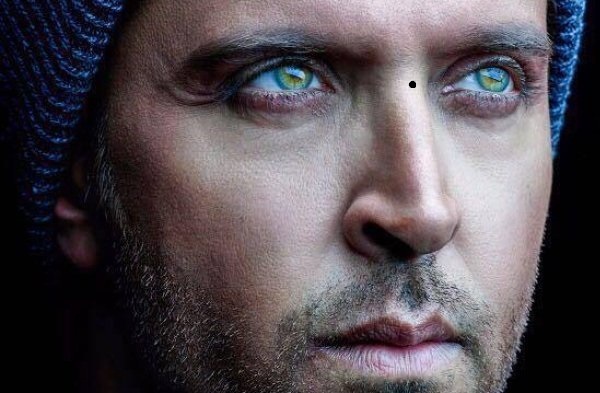 Những vị trí nốt ruồi của người đàn ông hao tài tốn của, ảnh hưởng lớn đến tài vận-3